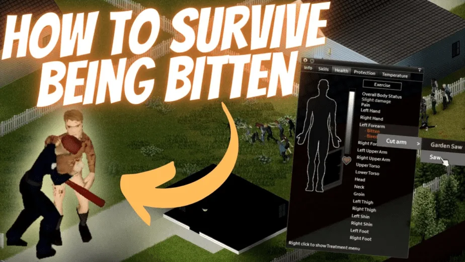 Surviving Bites In Project Zomboid